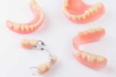 procedure-img13-300x169-1